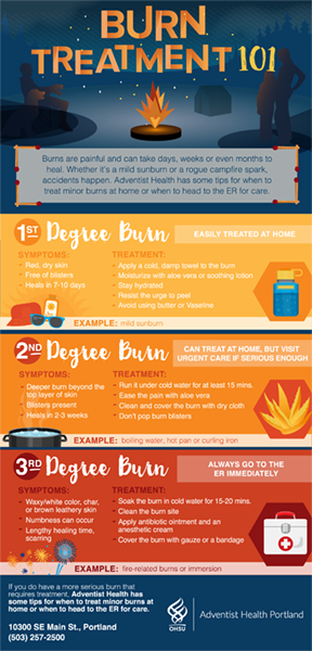 Burn safety tips, click to enlarge